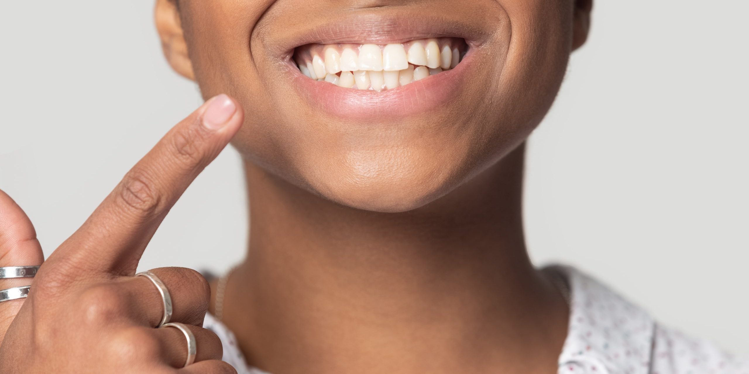 teeth whitening aurora co Teeth Whitening is an Important Part of Oral Health Care Dr. Rankin and Dr. Mingle Aurora Co teeth whitening aurora co Teeth Whitening is an Important Part of Oral Health Care Dr. Rankin and Dr. Mingle Aurora Co